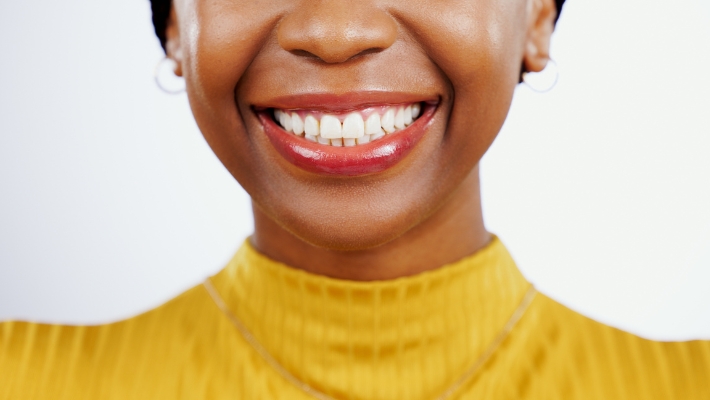 Facettes dentaires pour les dents sensibles 