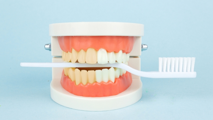 The risks and side effects of tooth whitening