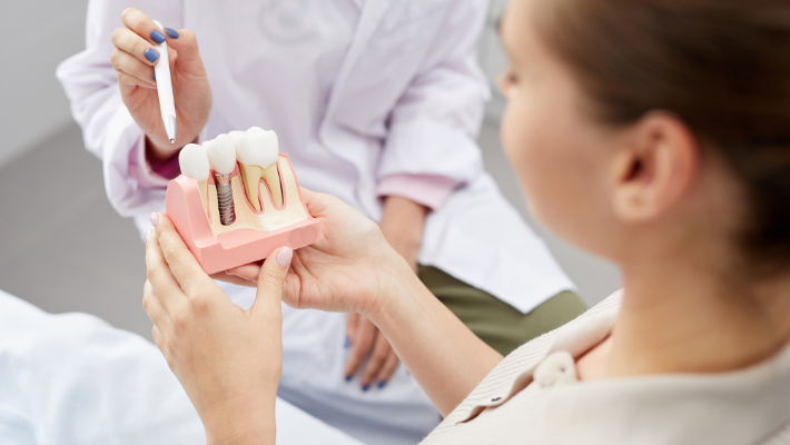 Les implants dentaires est une solution durable pour la perte de dents à Marrakech